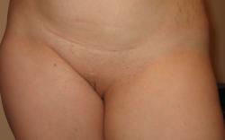 Pussy - front view 28/36