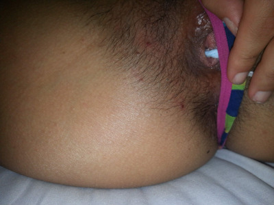 Photo 35
