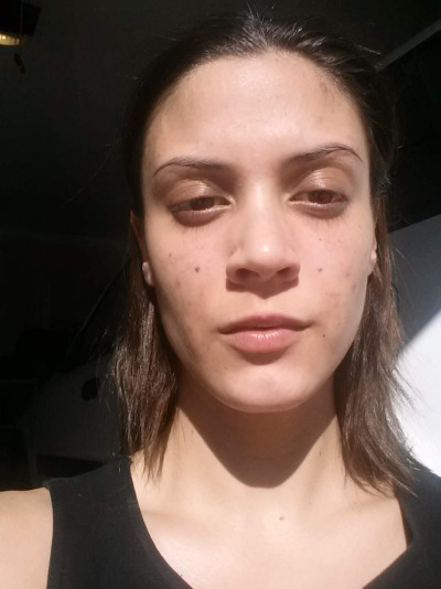 Photo 57