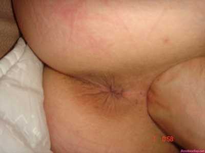 Photo 35