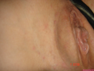 Photo 60