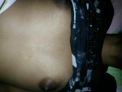 Photo 56