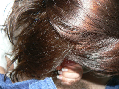 Photo 35