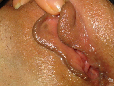 Photo 55